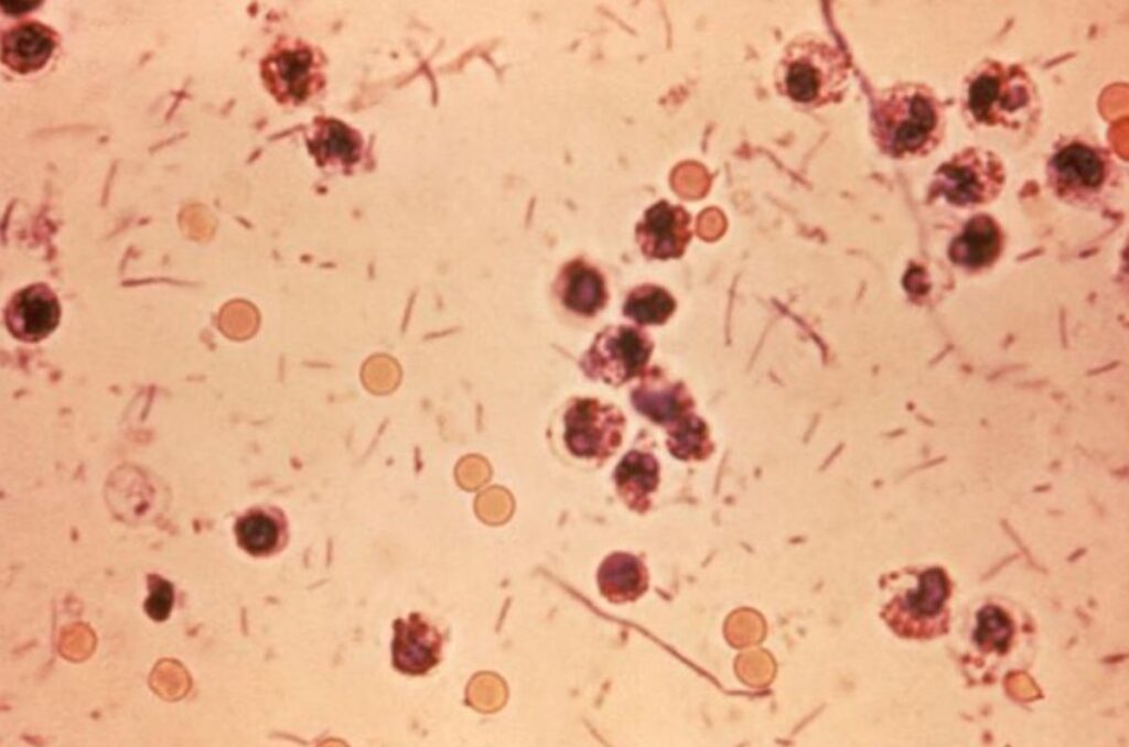 harmful pathogens in manure