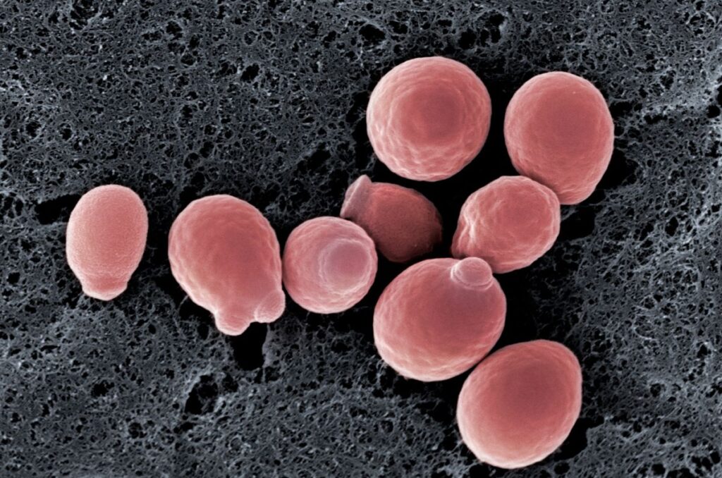 yeast cells
